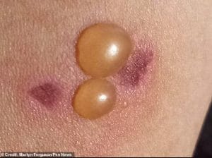 kaukázusi medvetalp